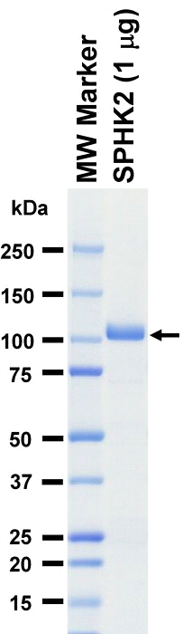 The purity was assessed by SDS-PAGE/CBB staining.